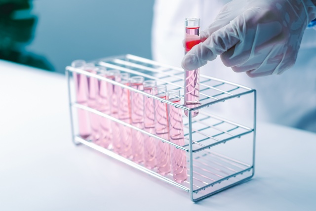 Application of Selenium-Enriched Yeast Protein Hydrolysate in Animal Cell Culture