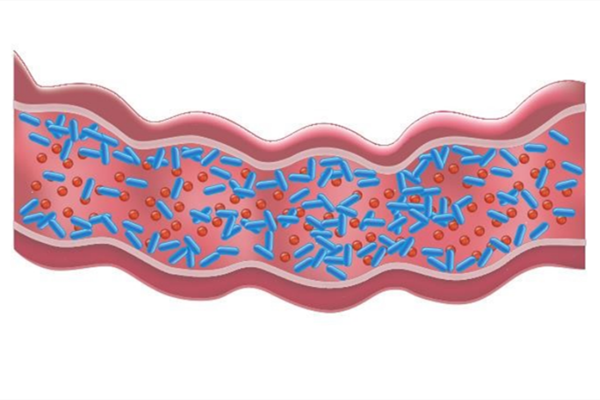YeaMOS-Soluble agglutinates pathogens more efficiently
