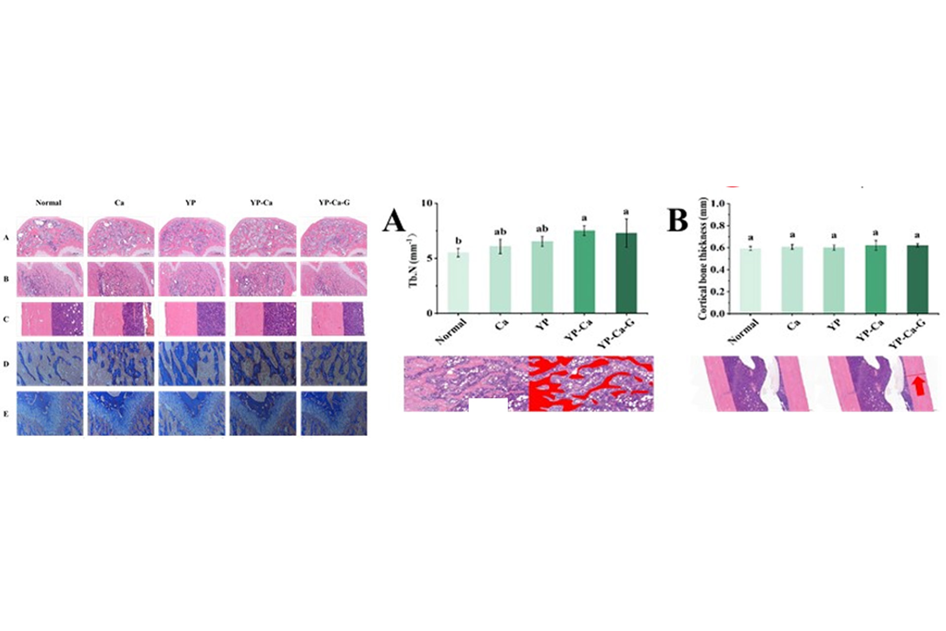 Effects-of-yeast-protein-supplementation-on-rat-trabecular-and-cortical-bone-thickness.jpg