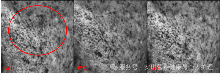 受试者（编号25）黑斑图像比照